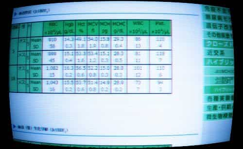 Hybrid Information -1