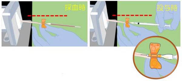 特徴２　血管の確保率がアップします！