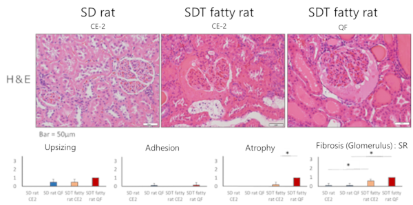 Histopathological findings (Glomerulus)