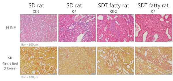 Histopathological findings (Renal tubule / Tubular interstitium)