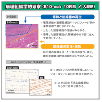  病理組織学的考察（B10-mdx 10週齢 ♂ 大腿筋）