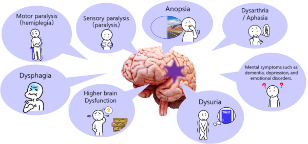 QOL refers to the "quality of life" in terms of the content of one's life and its social perception.