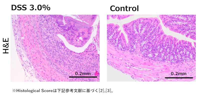 大腸炎の症状