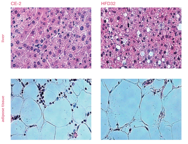 Photographs of liver and visceral adipose tissue (HE staining, ×400)-01