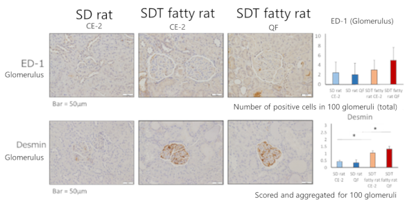 ED-1/Desmin immunohistochemical staining (Glomerulus)