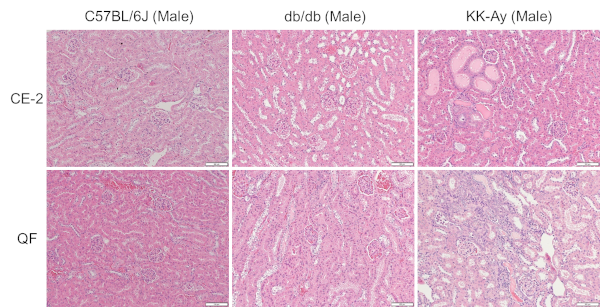 Kidney histopathological finding (HE staining)