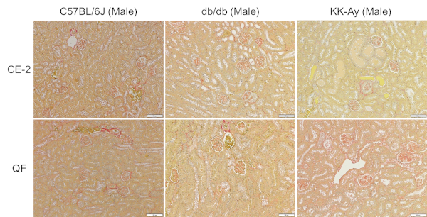 Kidney histopathological finding (Sirius Red staining)