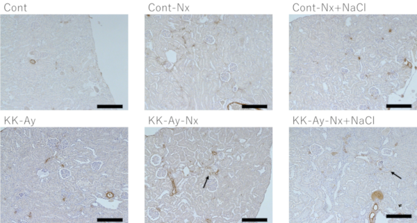 αSMA staining