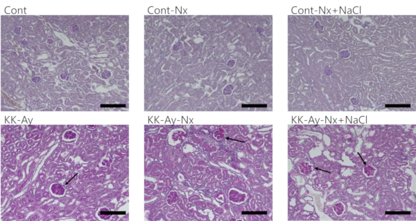 PAS staining