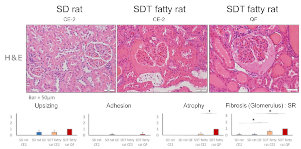 Histopathological findings (Glomerulus)