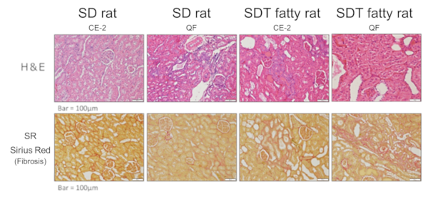 Histopathological findings (Renal tubule / Tubular interstitium)