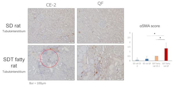 αSMA immunohistochemical staining (renal tubule/tubular interstitium)