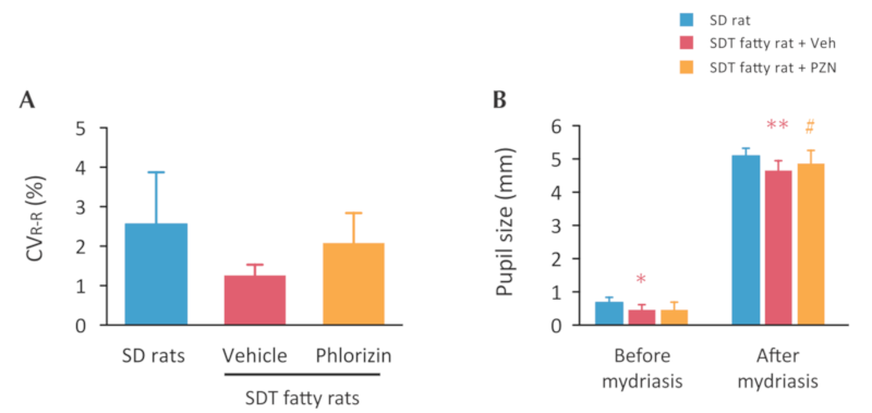 Autonomic nerve functions of SDT fatty rat for DPN model