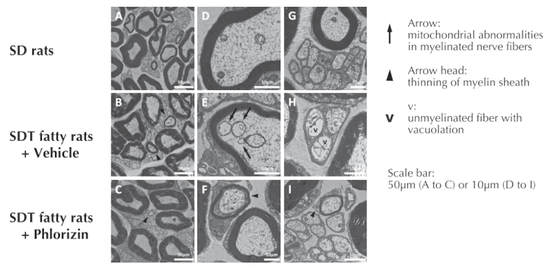 Electron micrographs of sural nerve of SDT fatty rat for DPN model