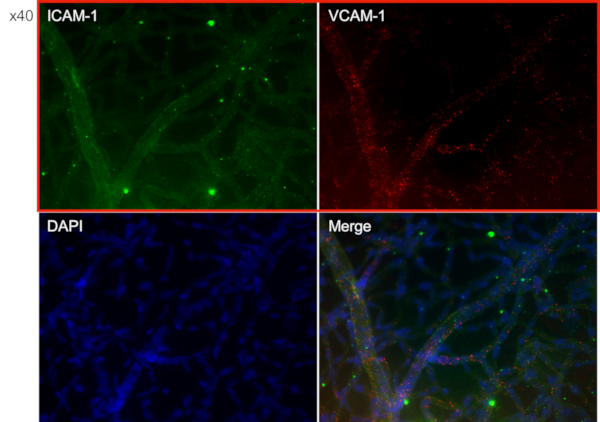 Immunostaining (SDT Fatty rats)