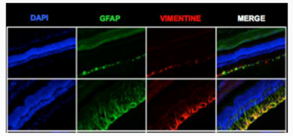 Unx SDT fatty rats show reactive gliosis in retina at 17 weeks of age