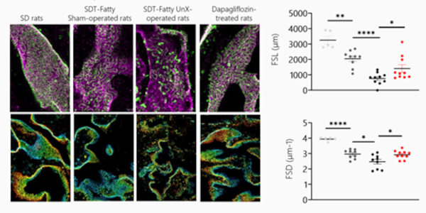 PEMP reveals that dapagliflozin improves podocyte effacement in Unx SDT fatty rats