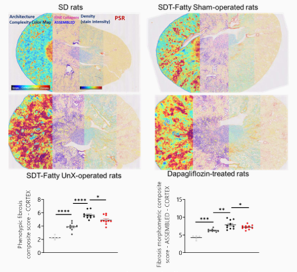 FibroNest platform uncovers the antifibrotic effects of dapagliflozin in the renal cortex of Unx SDT fatty rats