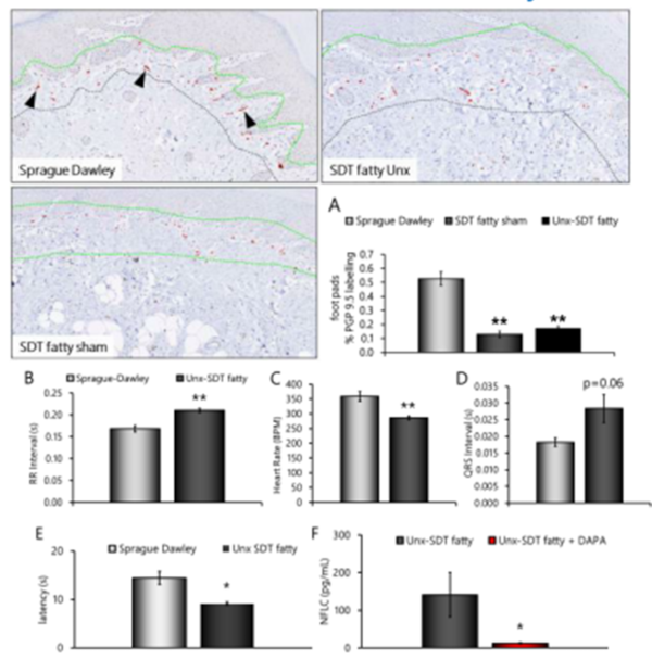 NF-L (plasma neurofilament light chain) changes in Unx SDT fatty rats