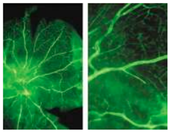 Figure-7 . Fluorescein angiography findings of the ocular of a male SDT rat (58 weeks of age)