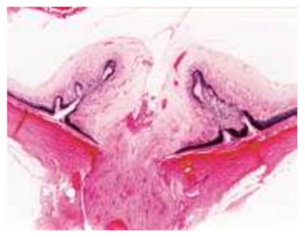 Figure-8 . Histopathological findings of the retina of a male SDT rat (70 weeks of age)