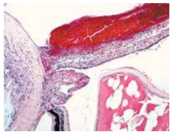 Figure-9 . Histopathological findings of the iris and Surrounding area of a male SDT rat (77 weeks of age)