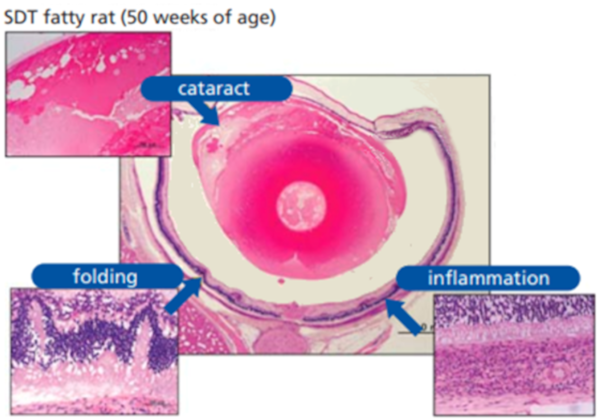 Figure-5 . Histopathological findings in ocular of female SDT fatty rat (50 weeks of age)