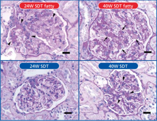Figure-6 . Histopathological findings in kidney of male SDT fatty rat (24,40 weeks of age)