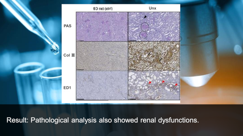 Result: Pathological analysis also showed renal dysfunctions.