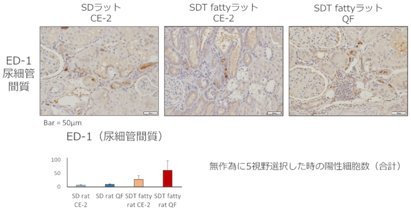 ED-1免疫組織化学染色（尿細管・尿細管間質）