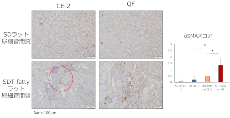 alphaSMA免疫組織化学染色（尿細管・尿細管間質）