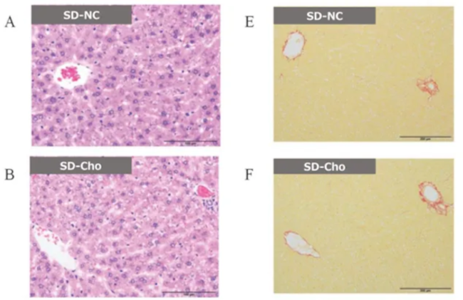 HE and SR staining liver histropathology A