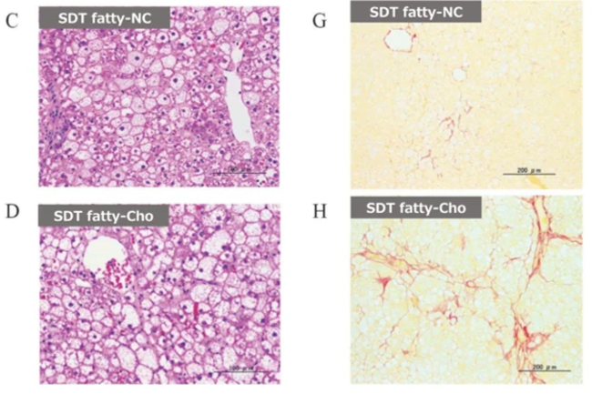 HE and SR staining liver histropathology B