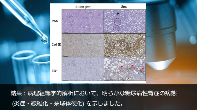 結果：病理組織学的解析において、明らかな糖尿病性腎症の病態 (炎症・線維化・糸球体硬化) を示しました。