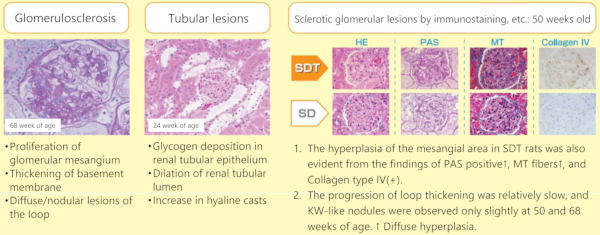 Diabetic nephropathy