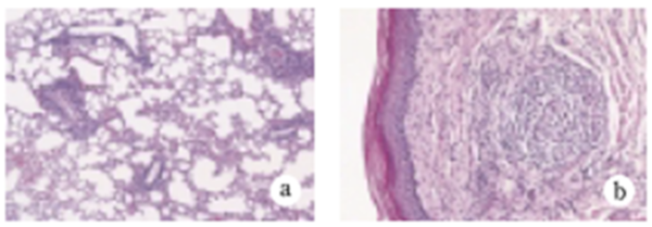 Fig.5 Extra-articular lesions