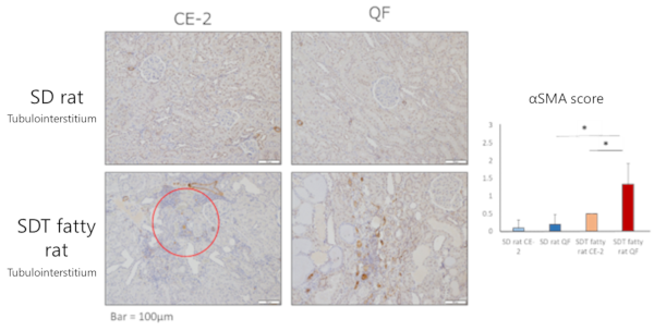 αSMA immunohistochemical staining (renal tubule/tubular interstitium)
