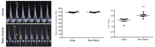 Heart Failure with Preserved Ejection Fraction（HFｐEF）