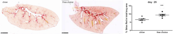 Sirius Red stain of Lung