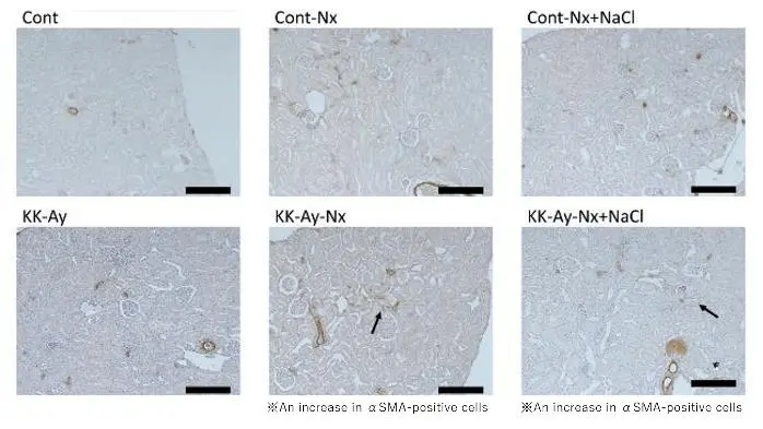 αSMA staining