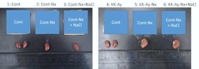 Kidney biopsy
