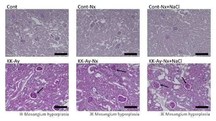 PAS staining