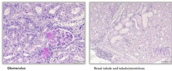 PAS staining