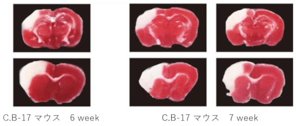 C.B-17 マウスの脳梗塞作製24時間後の組織イメージ（TTC染色）