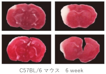 C57BL/6 マウスの脳梗塞作製24時間後の組織イメージ（TTC染色）